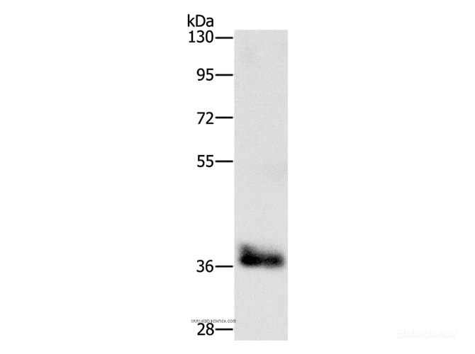 Western Blot analysis of Mouse liver tissue using CEBP epsilon Polyclonal Antibody at dilution of 1:650