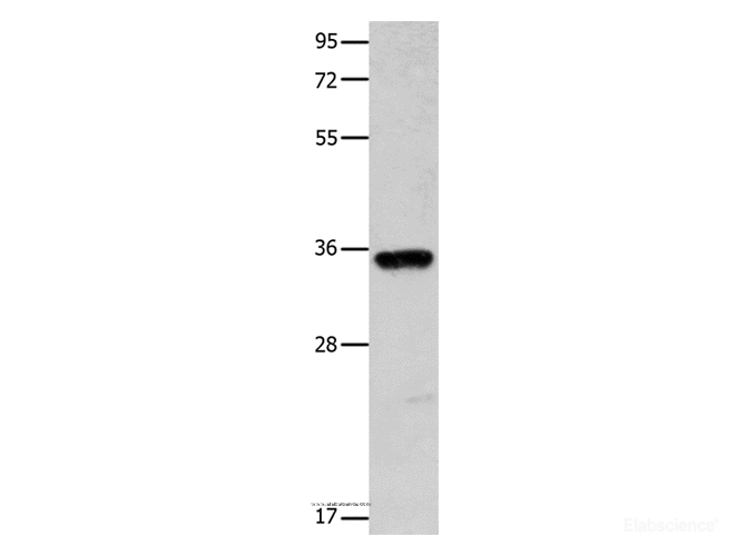 Western Blot analysis of Mouse brain tissue using COX11 Polyclonal Antibody at dilution of 1:600