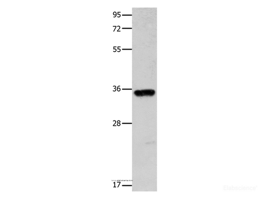 Western Blot analysis of Mouse brain tissue using COX11 Polyclonal Antibody at dilution of 1:600