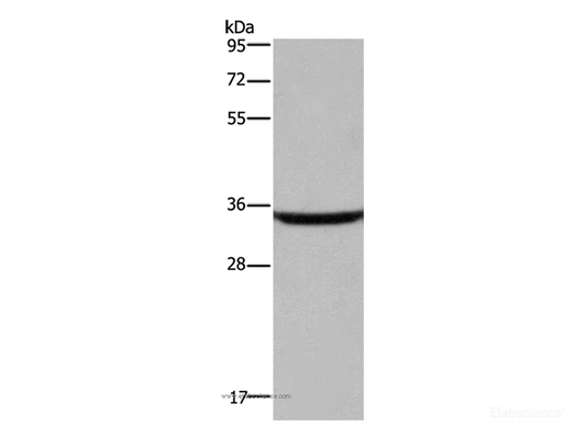 Western Blot analysis of Human fetal brain tissue using DKK3 Polyclonal Antibody at dilution of 1:200