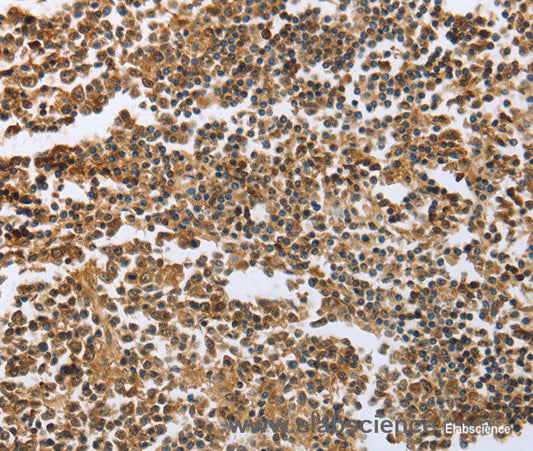 Immunohistochemistry of paraffin-embedded Human tonsil tissue using ECE1 Polyclonal Antibody at dilution 1:60