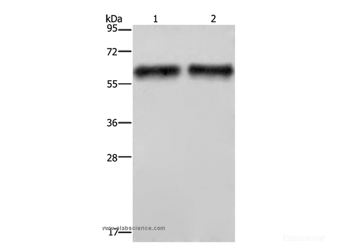 Western Blot analysis of Human hepatocellular carcinoma tissue   using ELN Polyclonal Antibody at dilution of 1:400