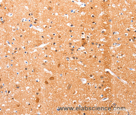 Immunohistochemistry of paraffin-embedded Human brain tissue using Ephrin A1 Polyclonal Antibody at dilution 1:51