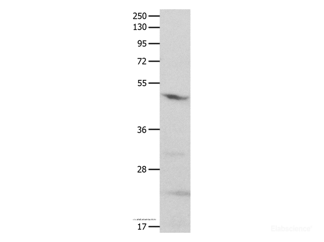 Western Blot analysis of Mouse brain tissue using GNAS Polyclonal Antibody at dilution of 1:500