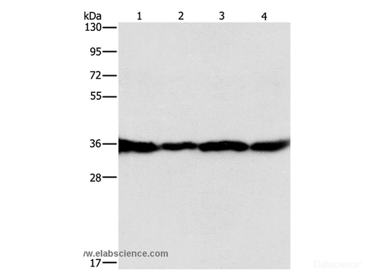 Western Blot analysis of HepG2, A549, 293T and 231 cell using GNB1 Polyclonal Antibody at dilution of 1:400