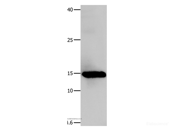 Western Blot analysis of Human fetal muscle tissue using Galectin 1 Polyclonal Antibody at dilution of 1:500