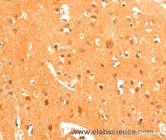 Immunohistochemistry of paraffin-embedded Human brain tissue using GRM3 Polyclonal Antibody at dilution 1:50