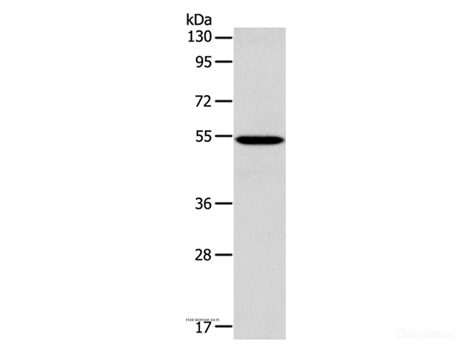 Western Blot analysis of 293T cell using ERG Polyclonal Antibody at dilution of 1:650