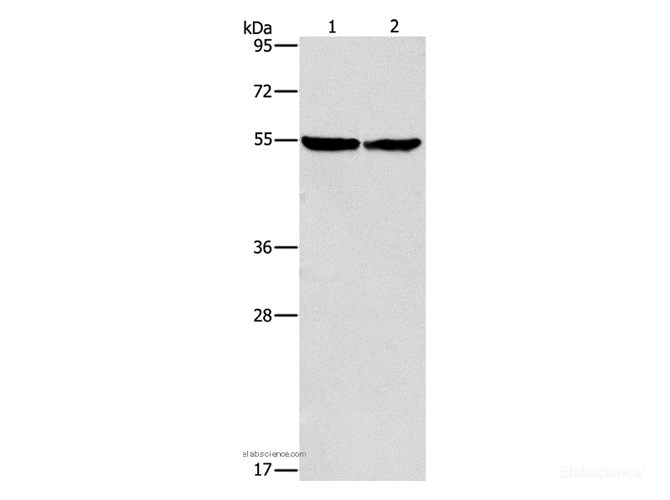 Western Blot analysis of Mouse heart tissue and hela cell using ILK Polyclonal Antibody at dilution of 1:600