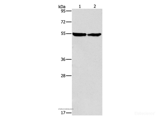 Western Blot analysis of Mouse heart tissue and hela cell using ILK Polyclonal Antibody at dilution of 1:600