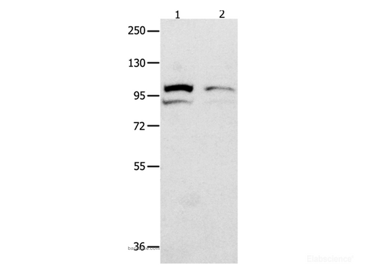 Western Blot analysis of 231 cell  and Mouse kidney tissue   using MVP Polyclonal Antibody at dilution of 1:500