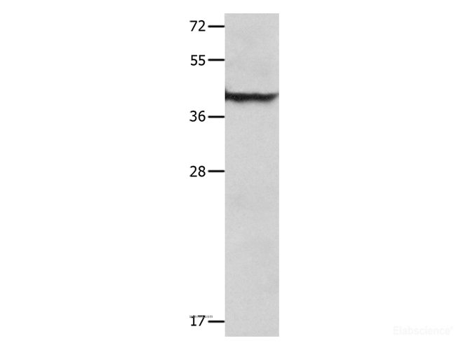 Western Blot analysis of Mouse lung tissue  using SERPINB5 Polyclonal Antibody at dilution of 1:1000
