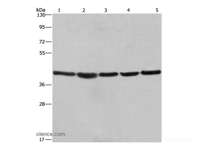 Western Blot analysis of A549, NIH/3T3 and 293T cell，Human hepatocellular carcinoma tissue and hela cell using RPSA Polyclonal Antibody at dilution of 1:433.3
