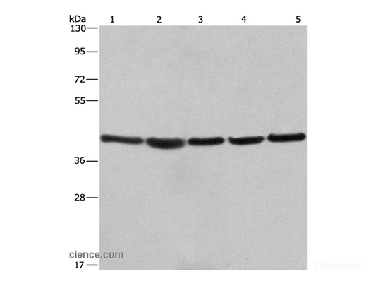 Western Blot analysis of A549, NIH/3T3 and 293T cell，Human hepatocellular carcinoma tissue and hela cell using RPSA Polyclonal Antibody at dilution of 1:433.3