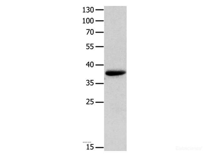Western Blot analysis of Mouse muscle tissue  using MYOZ1 Polyclonal Antibody at dilution of 1:1000
