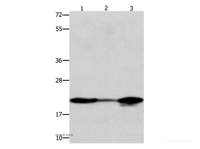 Western Blot analysis of 231 and A549 cell, Human liver cancer tissue  using NME1 Polyclonal Antibody at dilution of 1:600