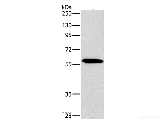 Western Blot analysis of A172 cell using PAK2 Polyclonal Antibody at dilution of 1:400