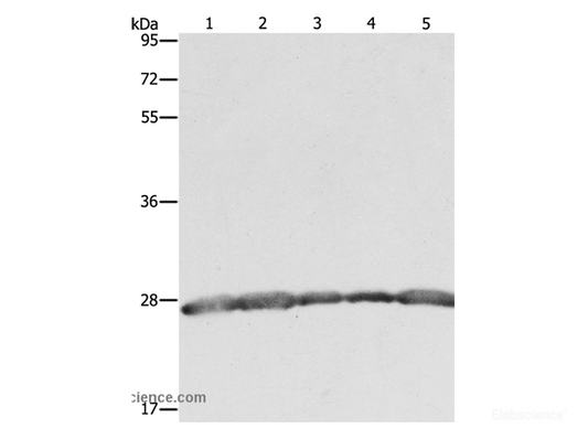Western Blot analysis of Hela, 293T and MCF7 cell, Human fetal brain tissue and Jurkat cell using PRDX3 Polyclonal Antibody at dilution of 1:800