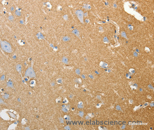 Immunohistochemistry of paraffin-embedded Human brain tissue using SLC4A4 Polyclonal Antibody at dilution 1:50