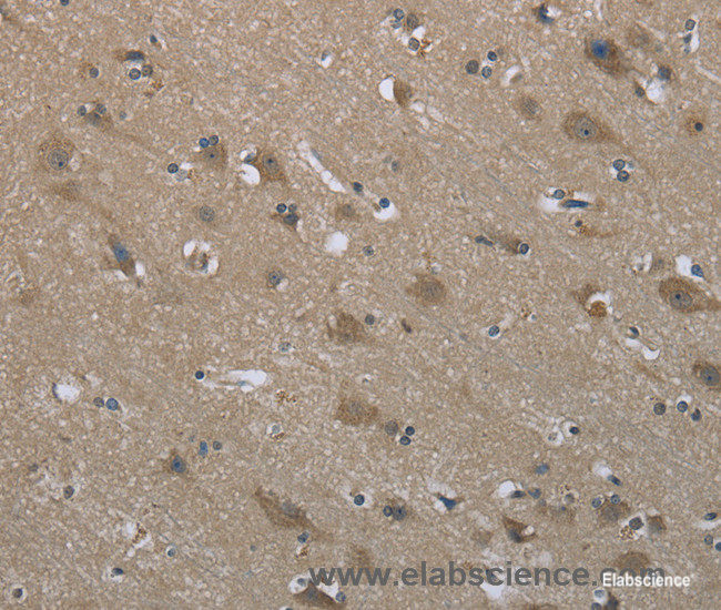 Immunohistochemistry of paraffin-embedded Human brain tissue using SYT3 Polyclonal Antibody at dilution 1:50