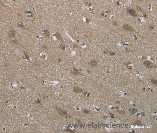 Immunohistochemistry of paraffin-embedded Human brain tissue using SYT3 Polyclonal Antibody at dilution 1:50