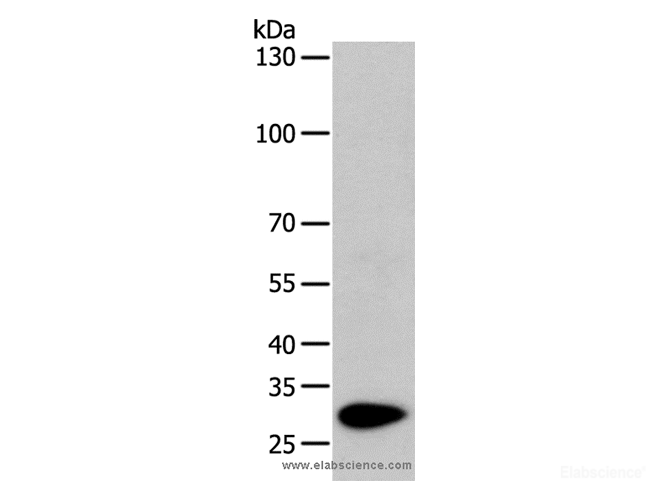 Western Blot analysis of Mouse heart tissue using TPM1 Polyclonal Antibody at dilution of 1:1000