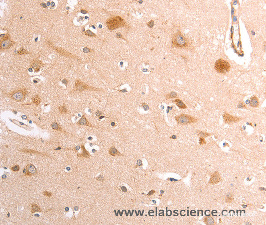 Immunohistochemistry of paraffin-embedded Human brain tissue using TRPV4 Polyclonal Antibody at dilution 1:40