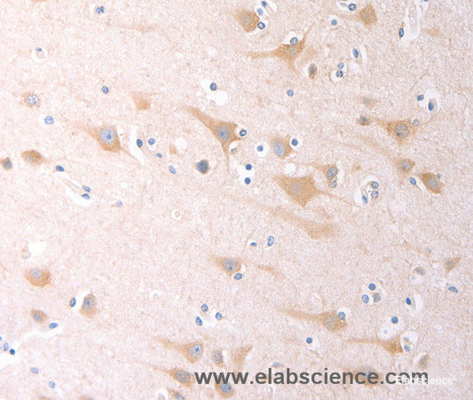 Immunohistochemistry of paraffin-embedded Human brain tissue using SCGB1A1 Polyclonal Antibody at dilution 1:60