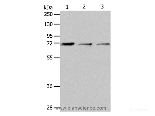 Western Blot analysis of RAW264.7 cell and Human liver cancer tissue, SP20 cell using CD218b Polyclonal Antibody at dilution of 1:650