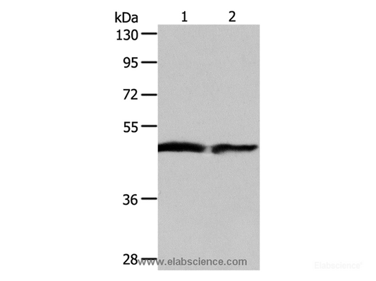 Western Blot analysis of Human fetal liver and liver cancer tissue using AADAC Polyclonal Antibody at dilution of 1:550