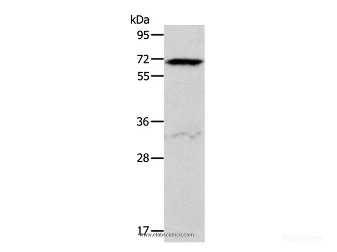 Western Blot analysis of Hela cell using ACVR2A Polyclonal Antibody at dilution of 1:400