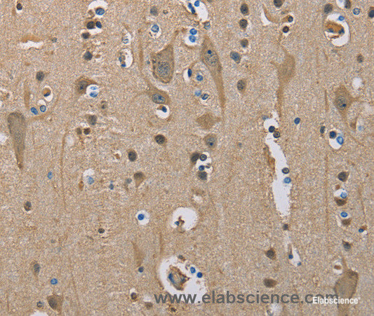 Immunohistochemistry of paraffin-embedded Human brain tissue using SERPINA1 Polyclonal Antibody at dilution 1:50