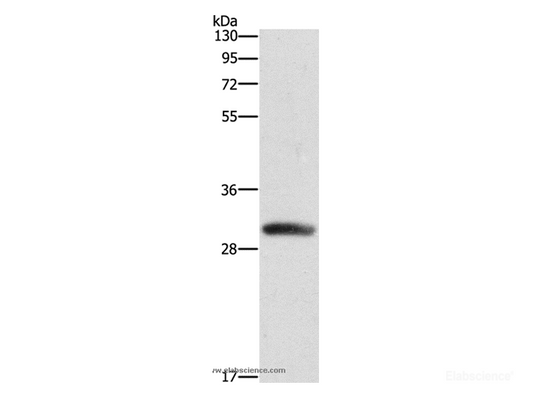 Western Blot analysis of Mouse heart tissue using DCK Polyclonal Antibody at dilution of 1:550