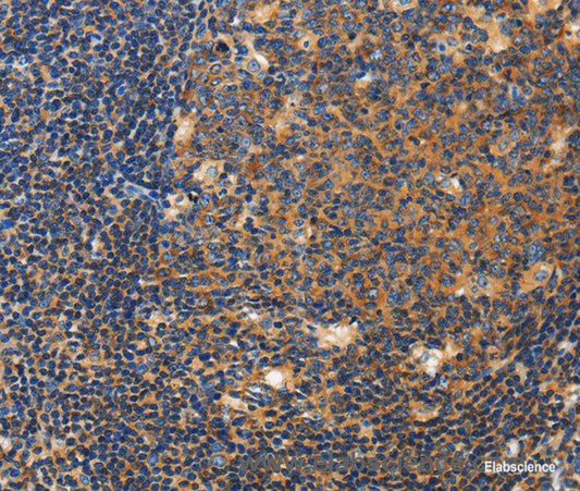 Immunohistochemistry of paraffin-embedded Human tonsil tissue using CERK Polyclonal Antibody at dilution 1:50