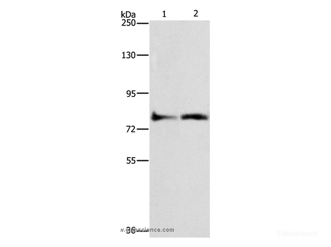 Western Blot analysis of Lovo cell and Mouse heart tissue using ASAH2 Polyclonal Antibody at dilution of 1:270