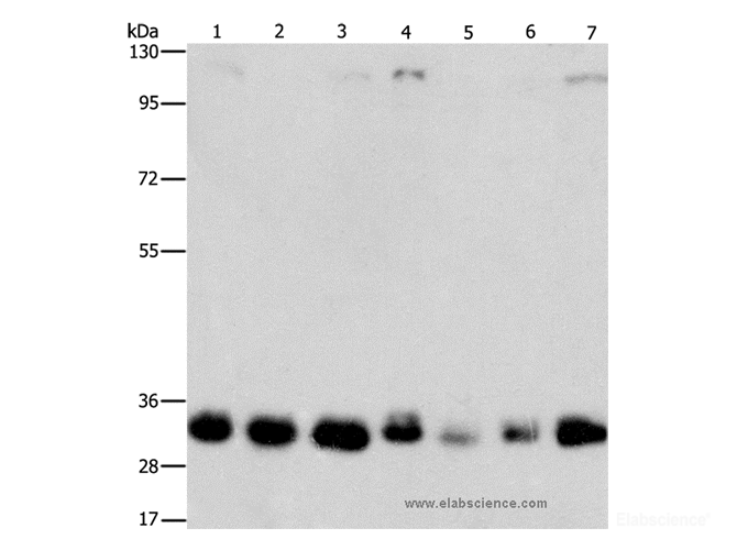Western Blot analysis of 231, 293T, Lovo, hepG2, A549, PC3 and A172 cell  using MPG Polyclonal Antibody at dilution of 1:1500