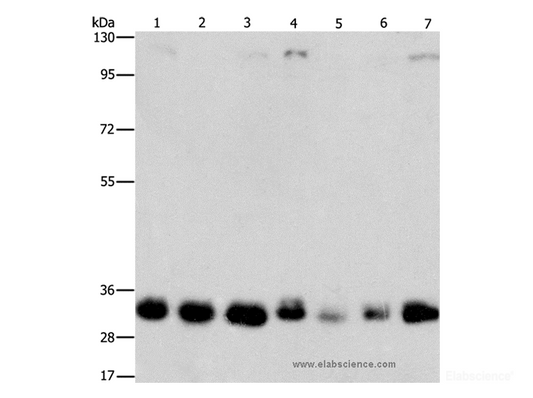 Western Blot analysis of 231, 293T, Lovo, hepG2, A549, PC3 and A172 cell  using MPG Polyclonal Antibody at dilution of 1:1500