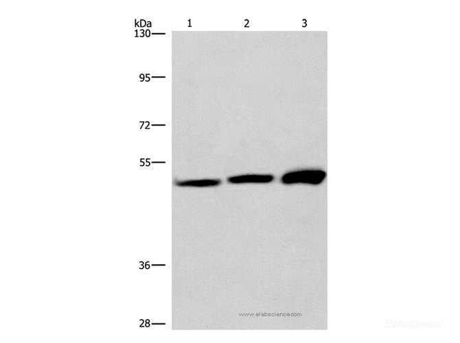 Western Blot analysis of adrenal pheochromocytoma tissue,Jurkat and A549 cell    using VWA5A Polyclonal Antibody at dilution of 1:275