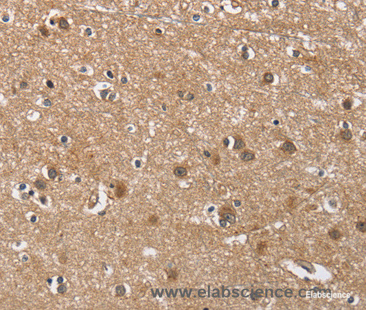 Immunohistochemistry of paraffin-embedded Human brain tissue using BUB1 Polyclonal Antibody at dilution 1:60
