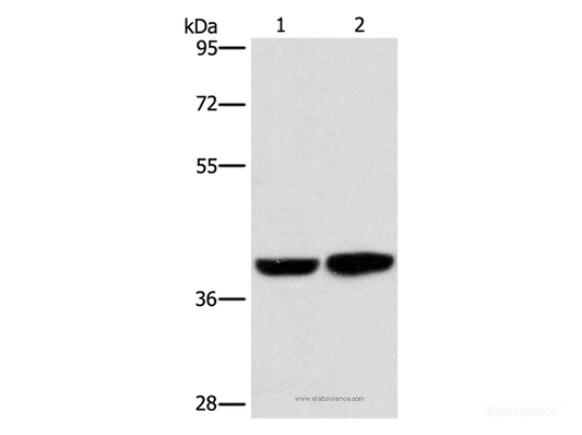 Western Blot analysis of Human fetal brain tissue and 231 cell using CAB39L Polyclonal Antibody at dilution of 1:350