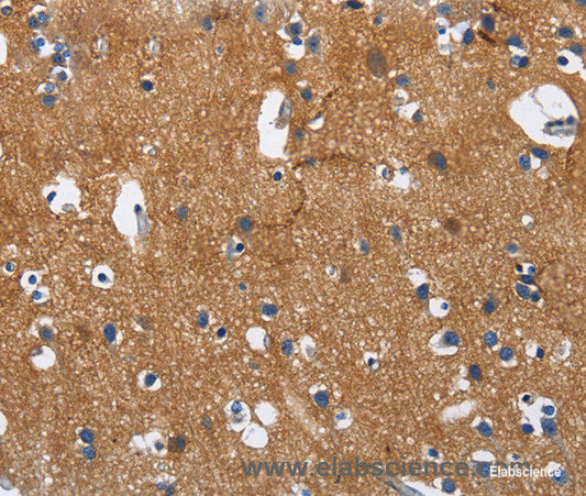 Immunohistochemistry of paraffin-embedded Human brain tissue using CADM3 Polyclonal Antibody at dilution 1:40