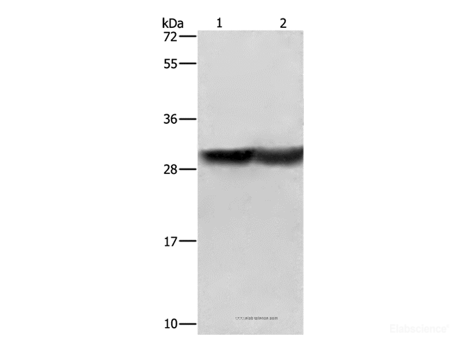 Western Blot analysis of Human fetal brain and Mouse kidney tissue   using CALB1 Polyclonal Antibody at dilution of 1:600