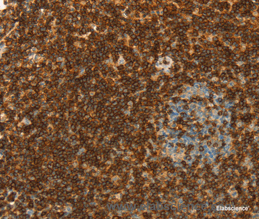 Immunohistochemistry of paraffin-embedded Human tonsil tissue using CD43 Polyclonal Antibody at dilution 1:30