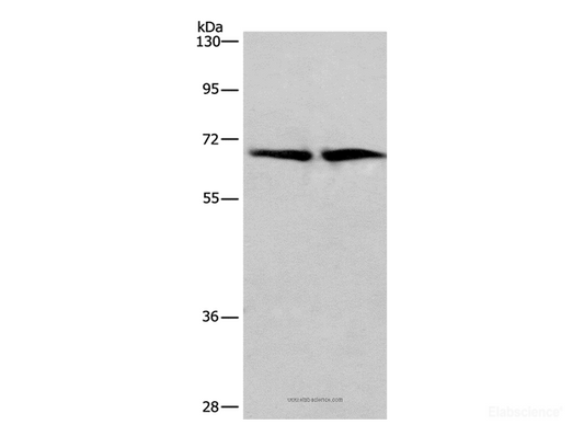 Western Blot analysis of Human brain malignant glioma and bladder carcinoma tissue using HSF27 Polyclonal Antibody at dilution of 1:449