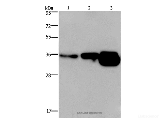 Western Blot analysis of Human breast infiltRative duct and fetal brain tissue, Mouse brain tissue   using CUEDC2 Polyclonal Antibody at dilution of 1:600