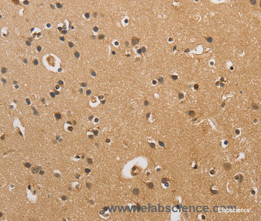 Immunohistochemistry of paraffin-embedded Human brain tissue using CST6 Polyclonal Antibody at dilution 1:70
