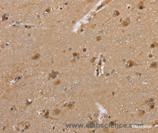 Immunohistochemistry of paraffin-embedded Human brain tissue using DLD Polyclonal Antibody at dilution 1:35