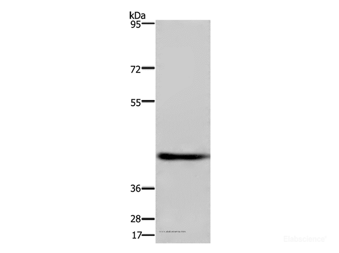 Western Blot analysis of Human fetal brain tissue using DRG1 Polyclonal Antibody at dilution of 1:500