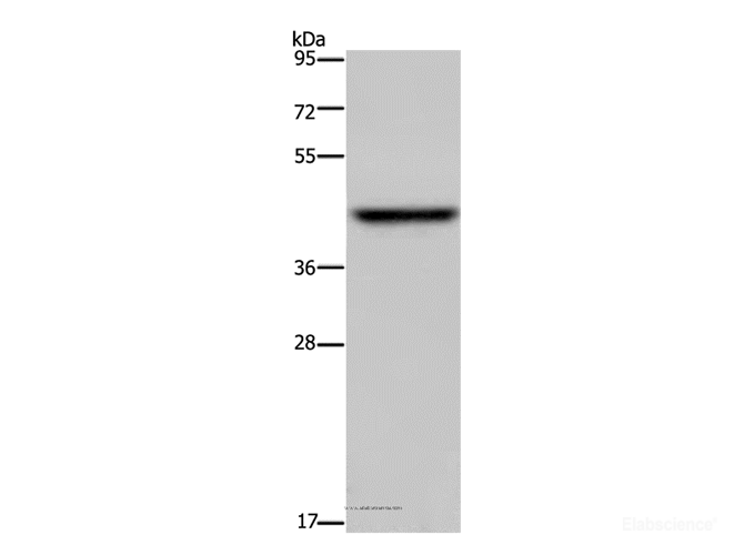 Western Blot analysis of Mouse liver tissue using ENTPD5 Polyclonal Antibody at dilution of 1:500