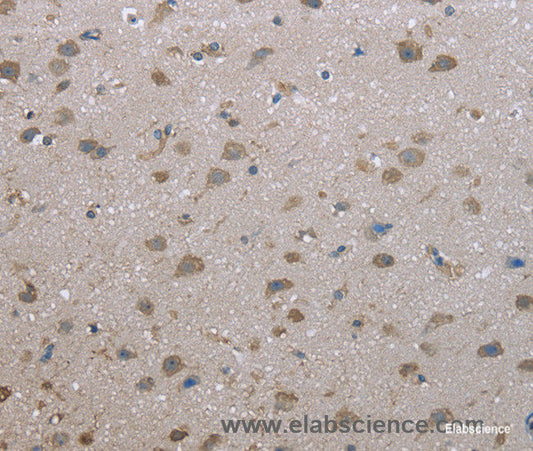 Immunohistochemistry of paraffin-embedded Human brain tissue using FAP Polyclonal Antibody at dilution 1:30